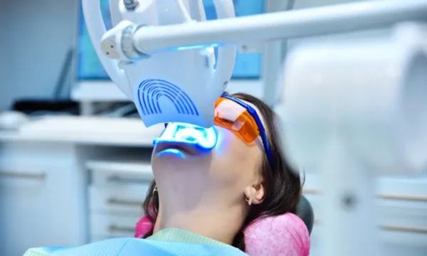 Teeth Whitening