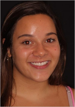 Cosmetic dentistry treatment at dentistry of the queen city